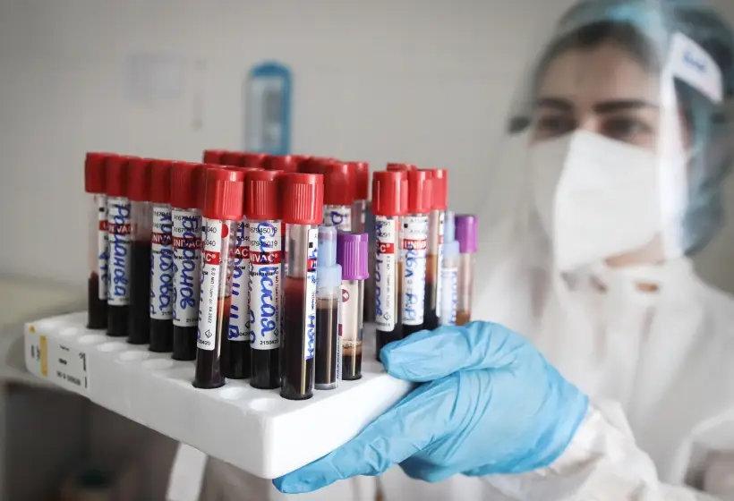 Для диагностики эффективны стандартные тест-системы, используемые для выявления COVID-19. Фото